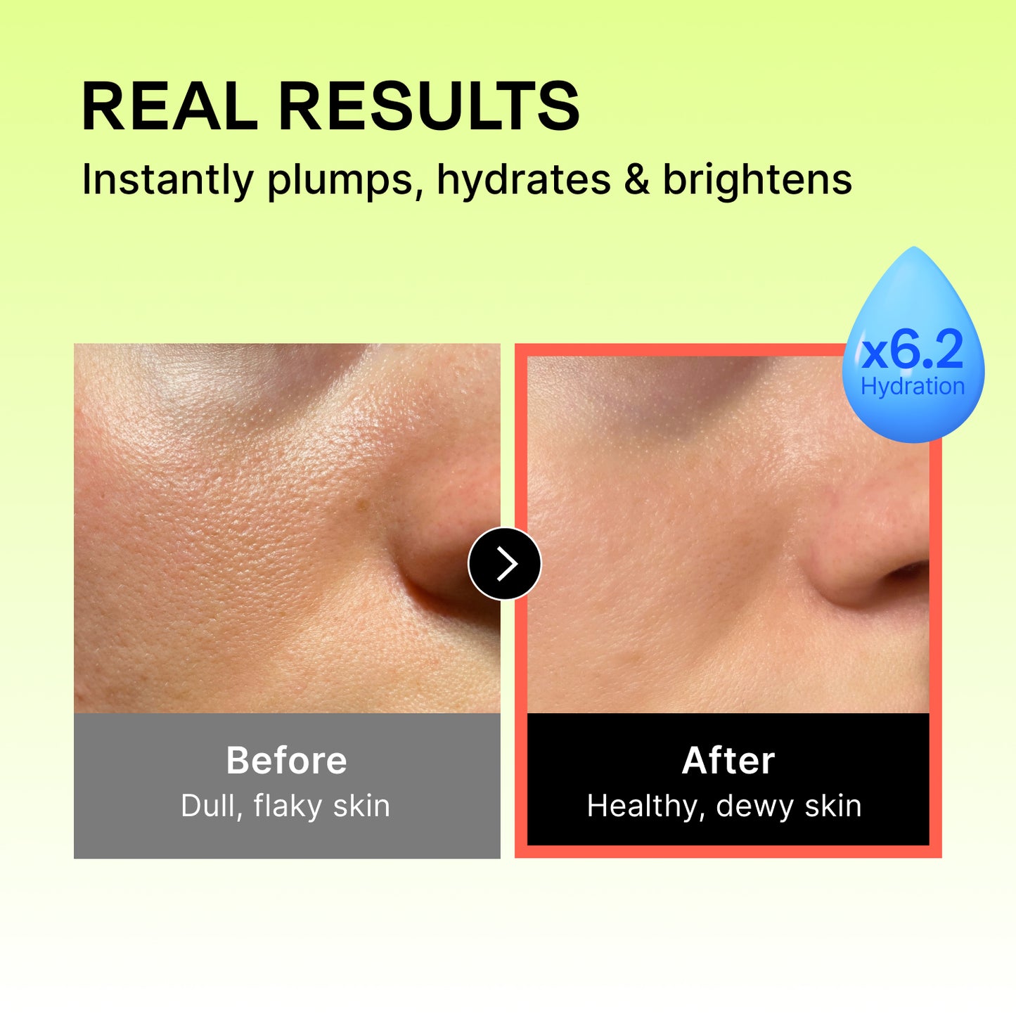 Hyaluronic Intense Serum