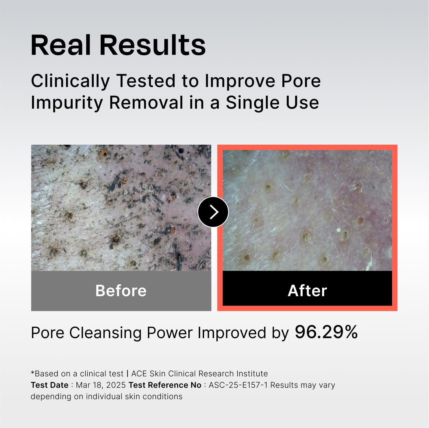 131 Pore Care BHA Cleanser｜Celladix – Celladix SG