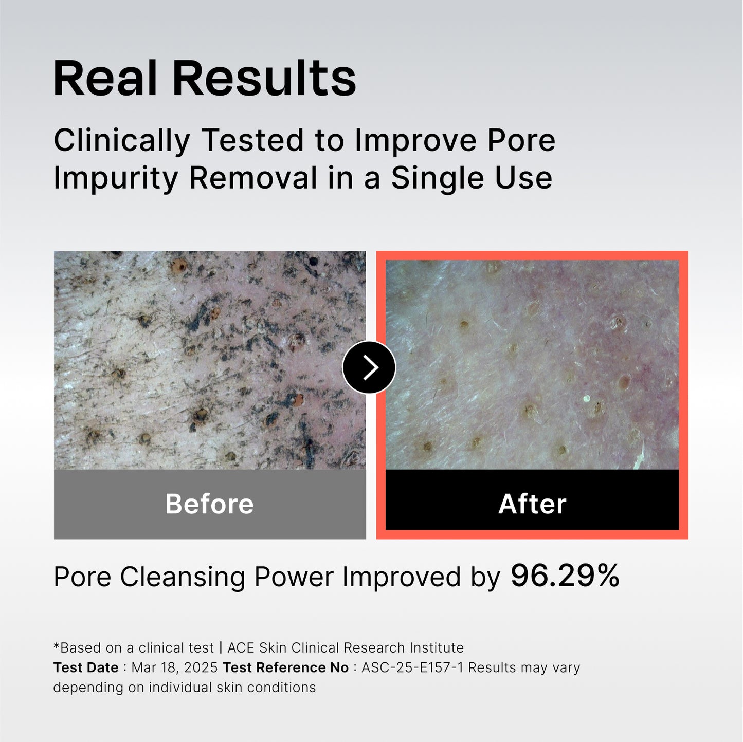 131 Pore Care BHA Cleanser